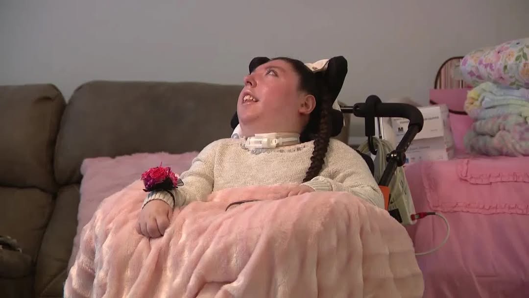 Cette Jeune Fille N e Sans Cerveau F te Ses 20 Ans Un Miracle Pour cette-jeune-fille-n-e-sans-cerveau-f-te-ses-20-ans-un-miracle-pour